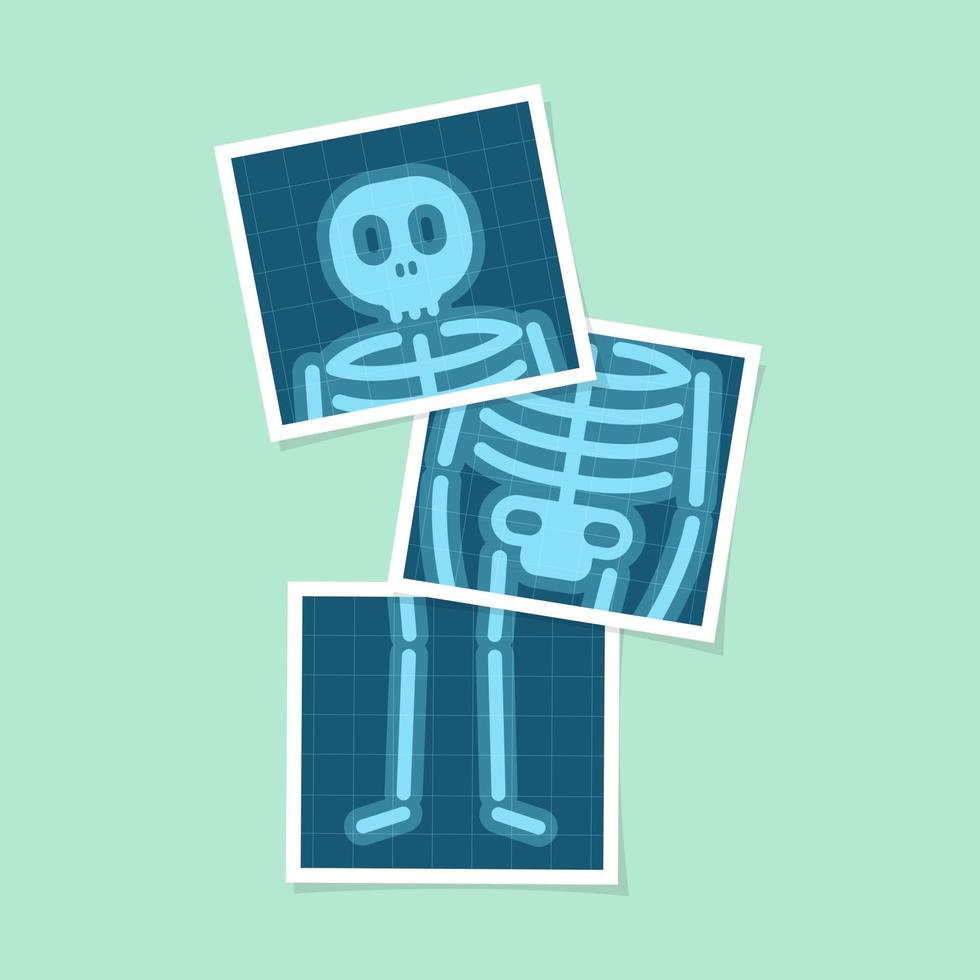 Set of body X-rays film of human body cartoon. vector