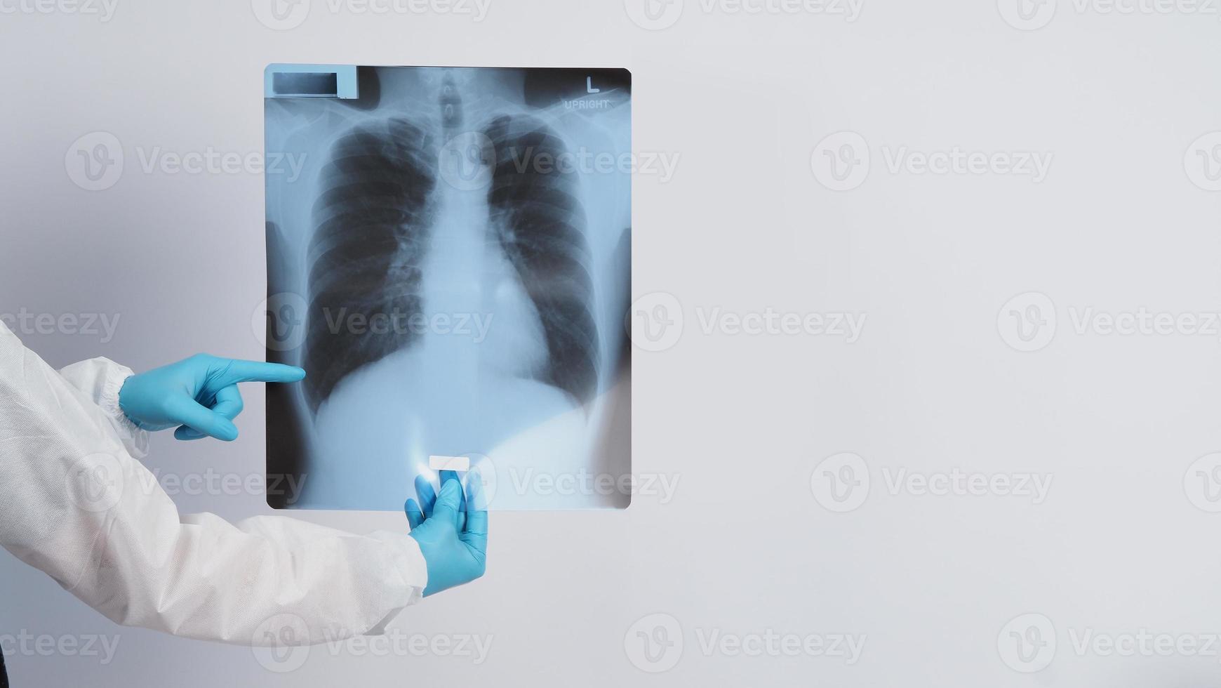 Película de rayos x de pulmones en manos de médicos foto