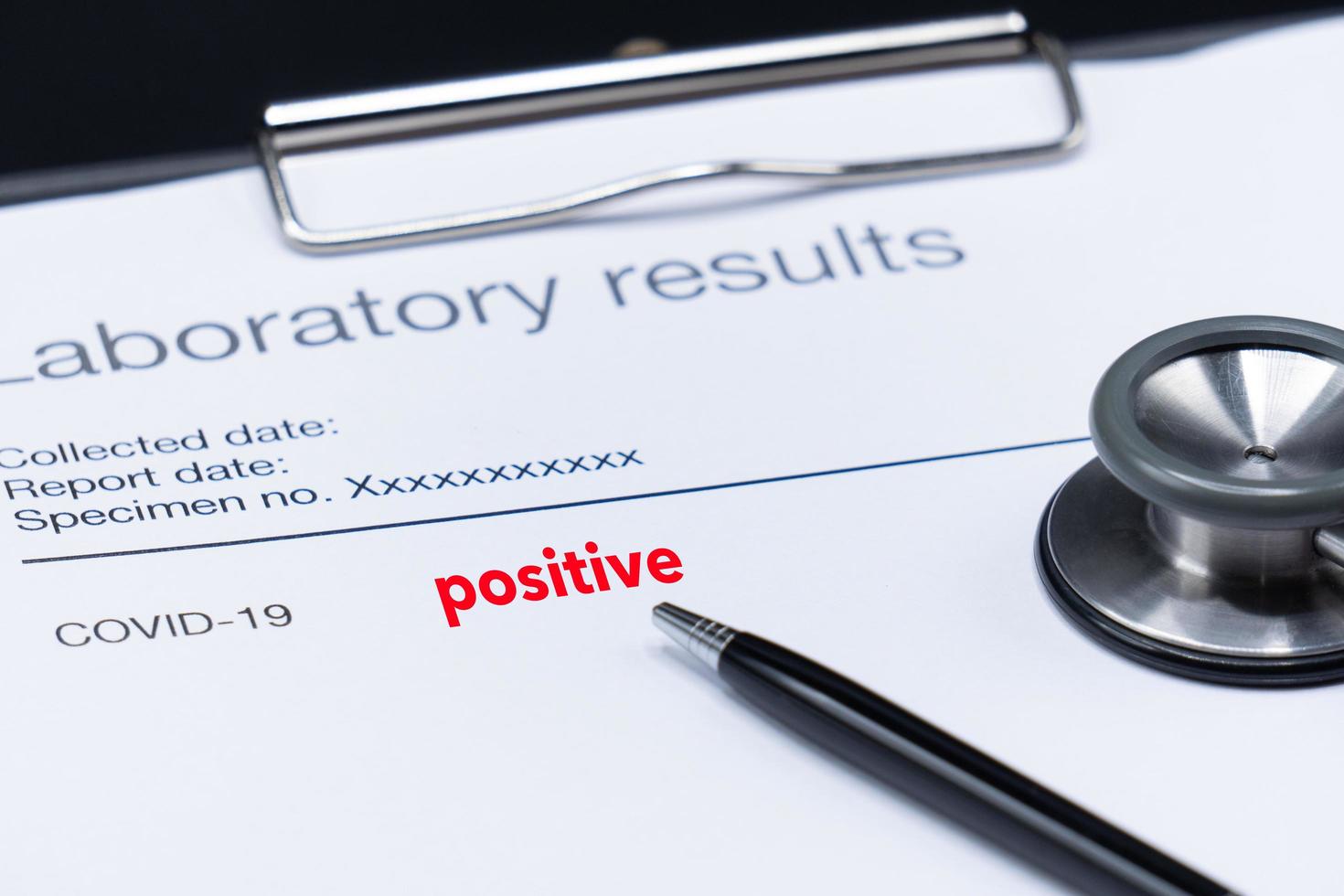 Laboratory results of a patient that positive for COVID 19 or corona virus with a pink stethoscope on the black background photo