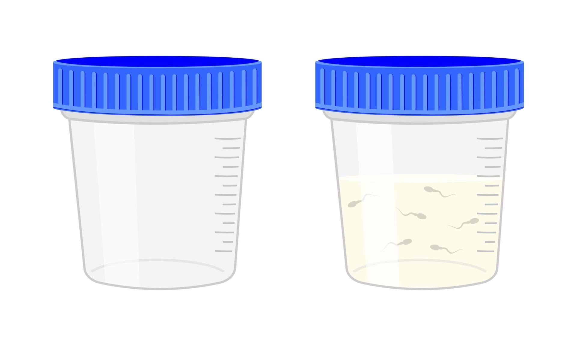 Semen Analysis Sperm Sample Plastic Container Empty And Full Isolated