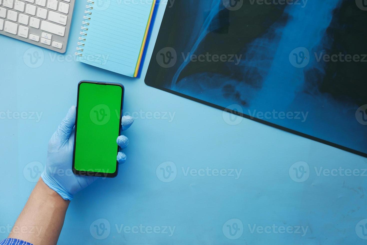 Xray and smart phone on blue background photo