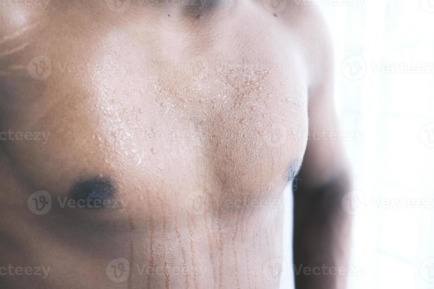 Young man skin sweating in chests photo