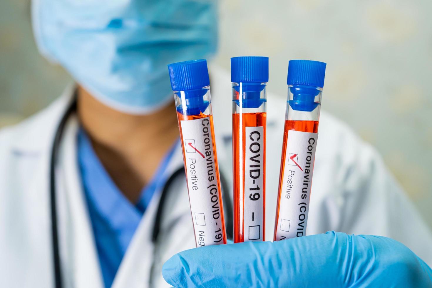 Positive blood infection sample in test tube for covid-19 coronavirus in lab. Scientist holding to check and analyze for patient in hospital. photo