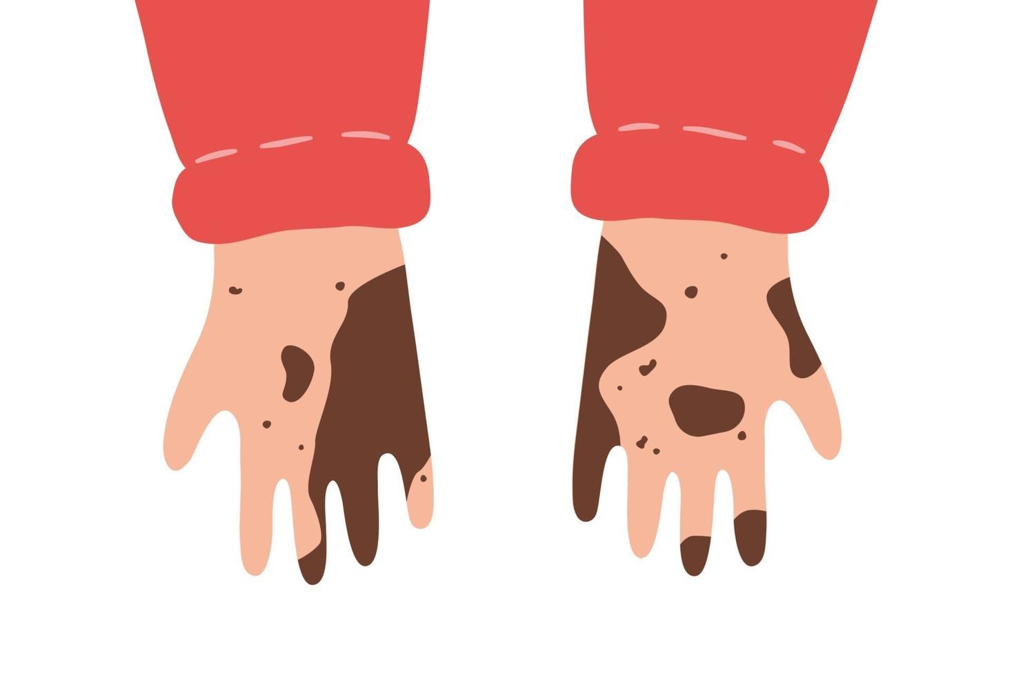 Dirty unwashed hands. Isolated vector illustration in flat style