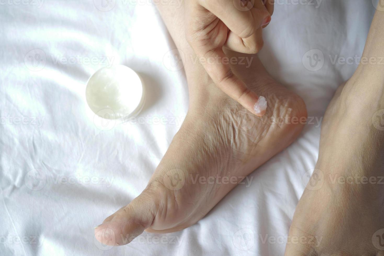 woman using petroleum jelly onto feet on bed photo