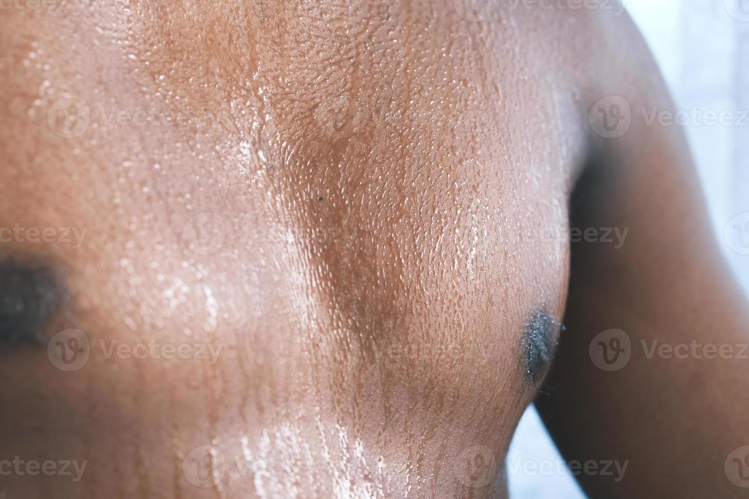 young man skin sweating in chests . photo