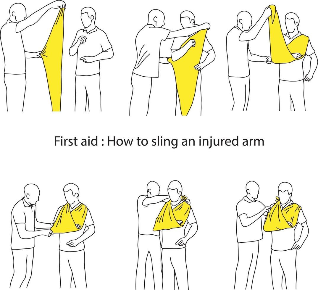 How to sling an injured arm vector illustration