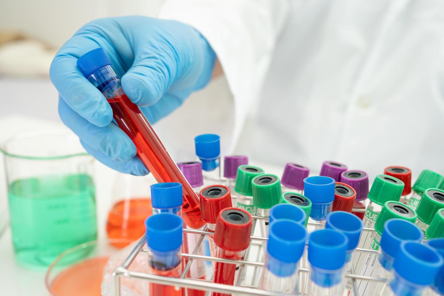 Scientist holding and analysis tube of micro biological photo