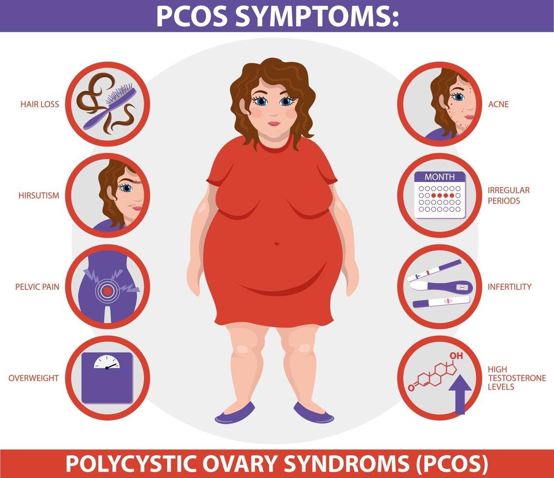 síntomas pcos una mujer vector