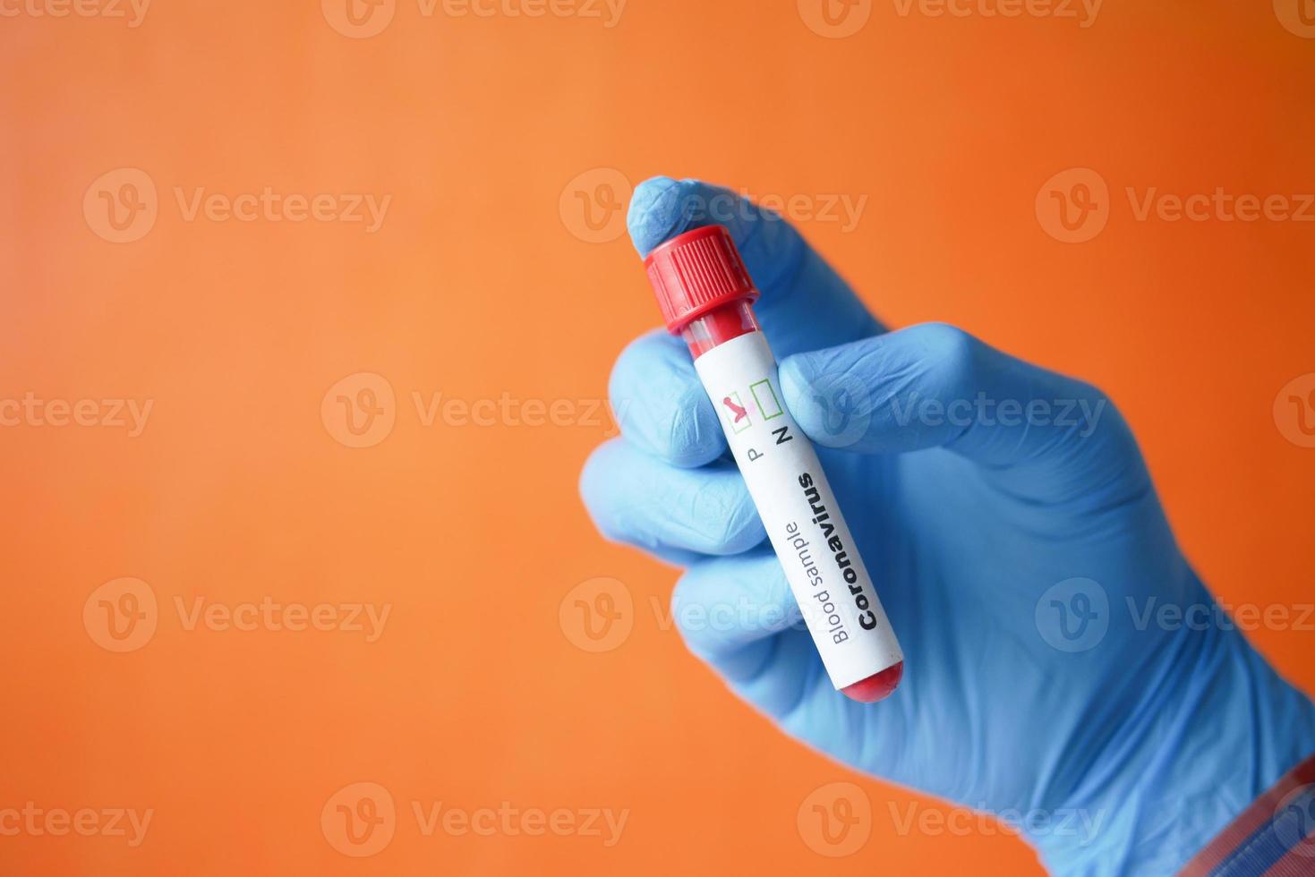 hand in blue medical gloves holding blood test tube photo