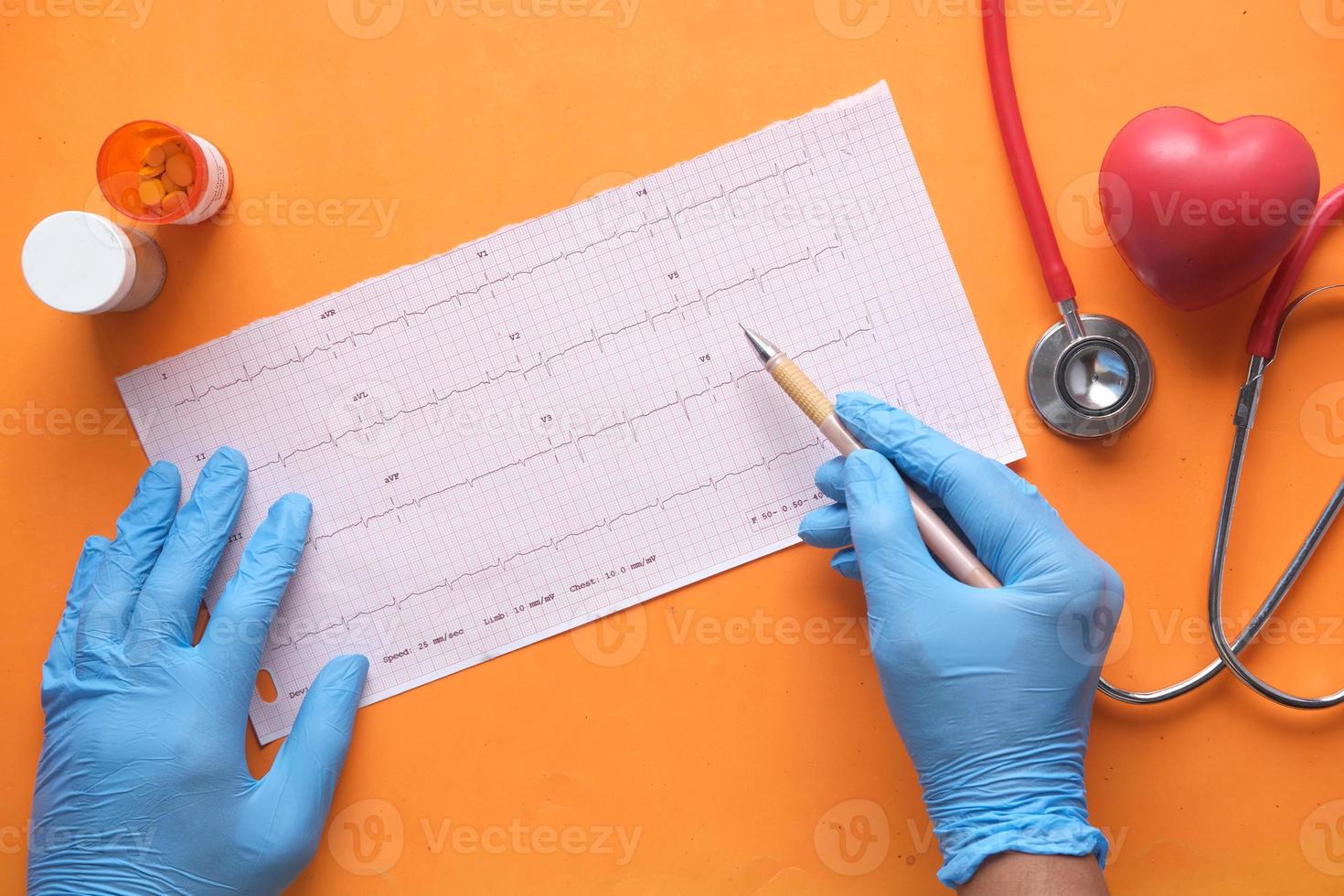 Mano del doctor en guantes médicos analizando el diagrama de cardio. foto