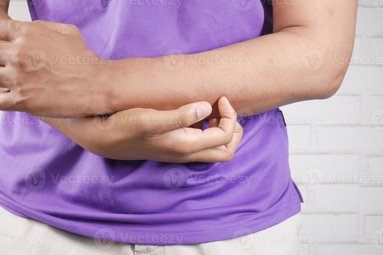 man suffering from itching skin, close up. photo