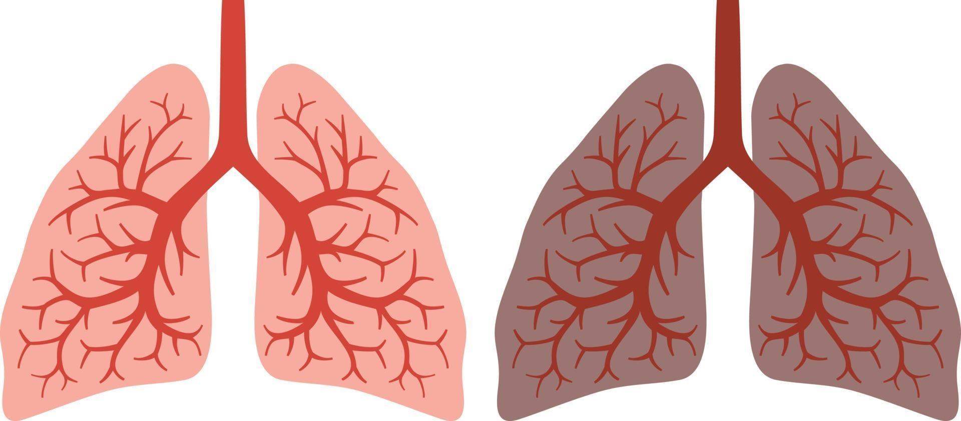 Healthy and Smokers Lung Before and After a Lifetime of Smoking vector