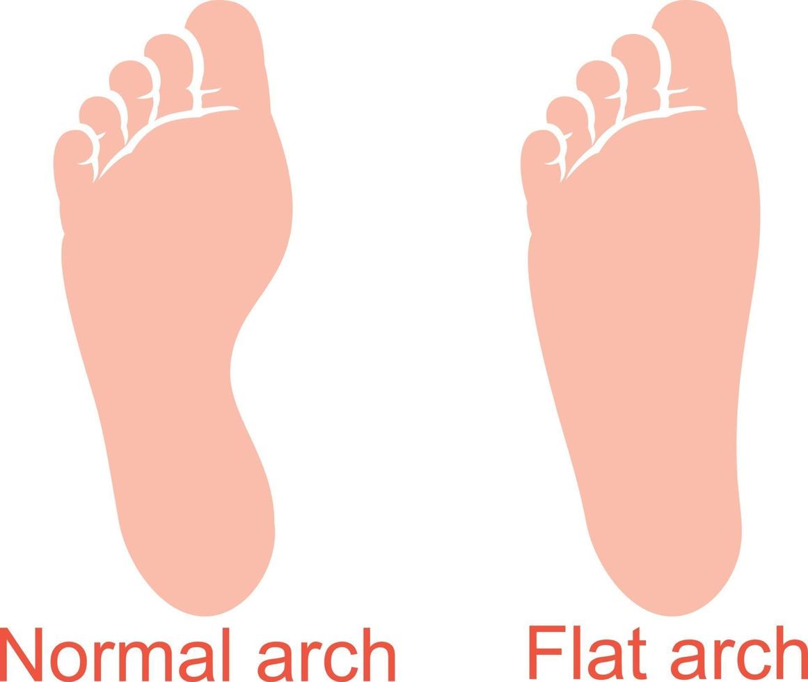 arco normal y plano vector