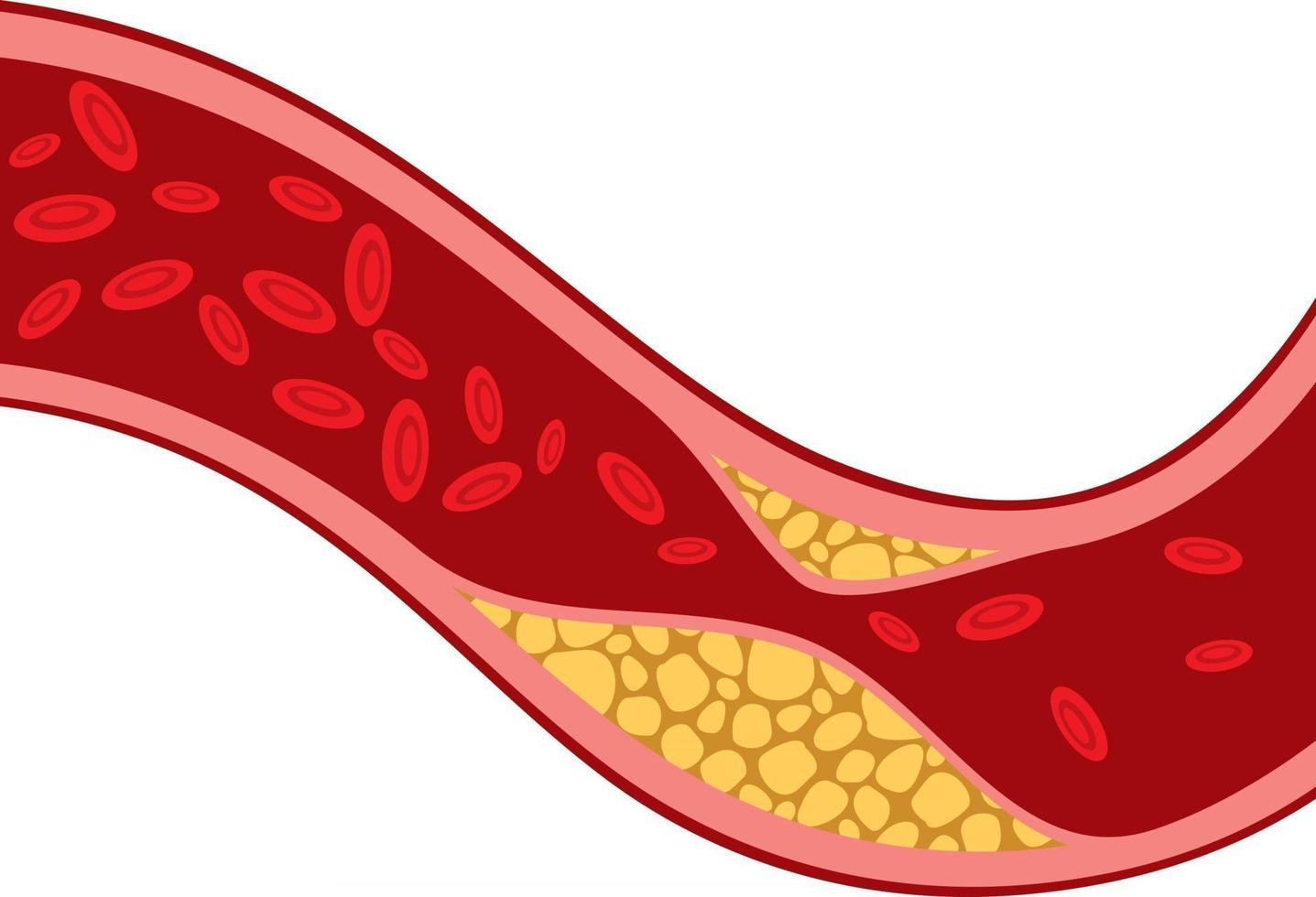 ilustración vectorial de colesterol vector