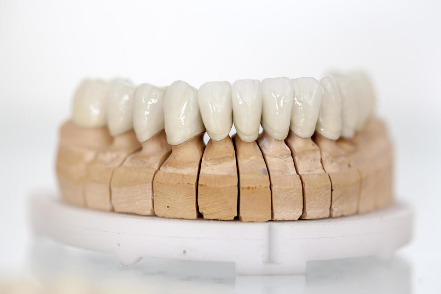 Zirconium Porcelain Tooth plate photo