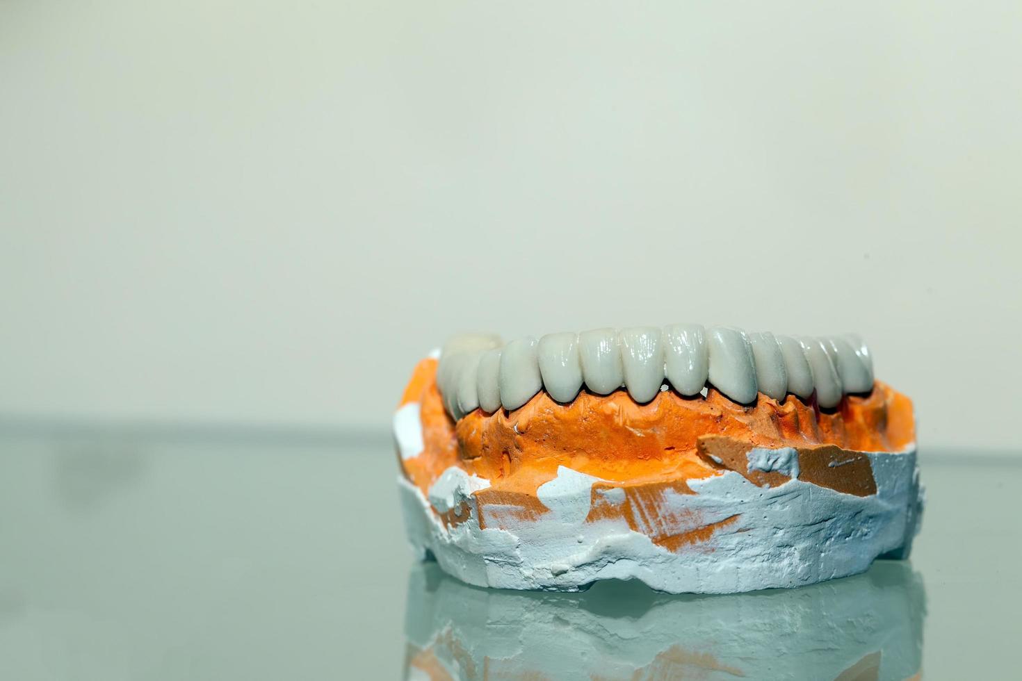 Zirconium Porcelain Tooth plate in Dentist Store photo