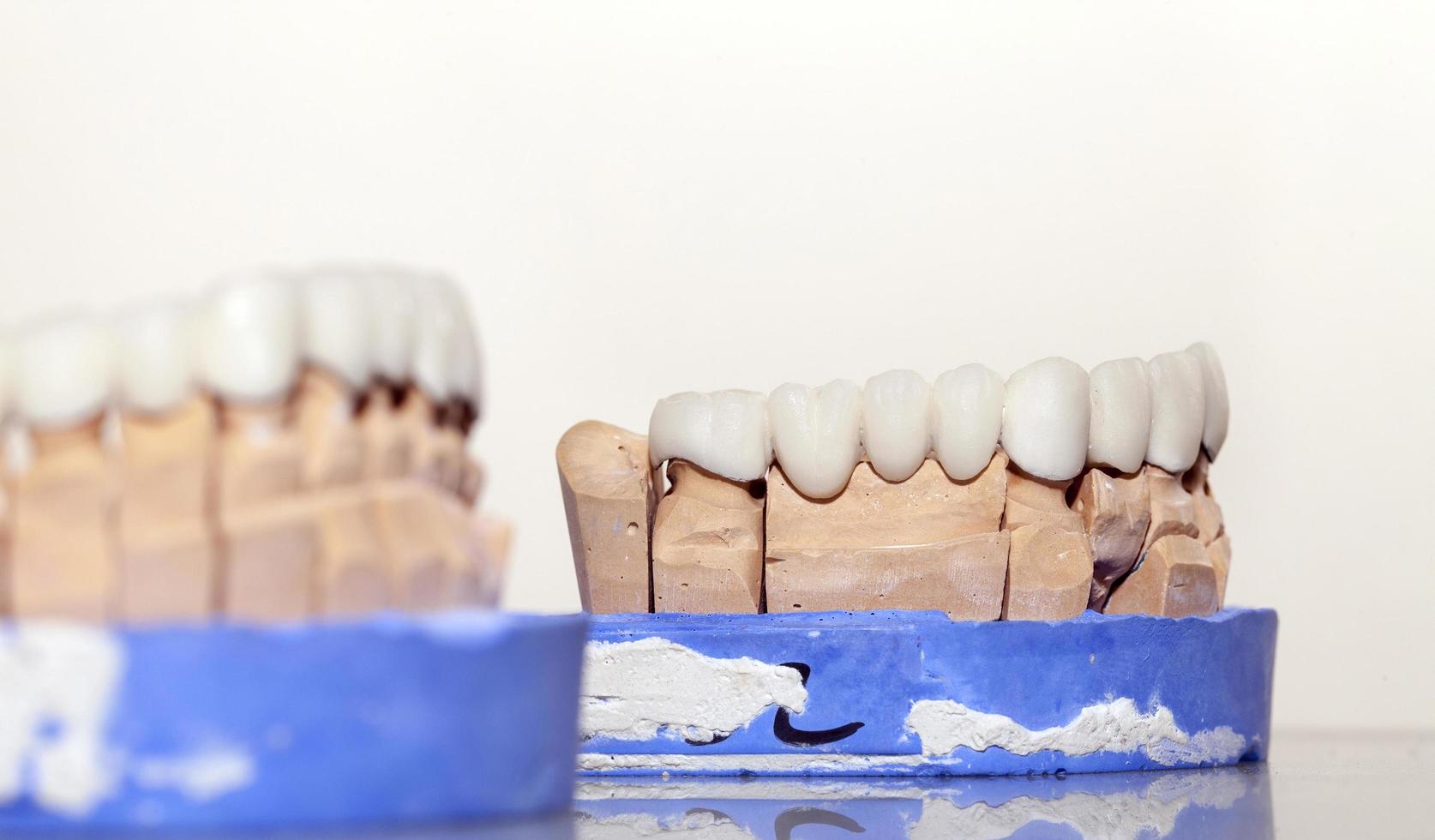 Zirconium Porcelain Tooth plate in Dentist Store photo