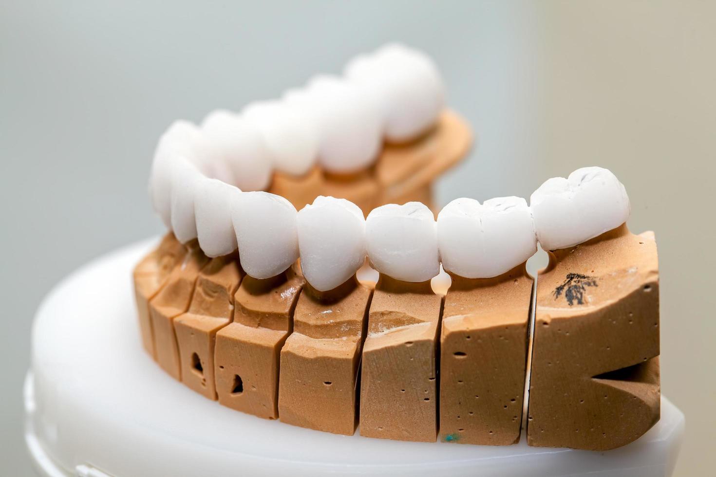 Zirconium Porcelain Tooth plate in Dentist Store photo