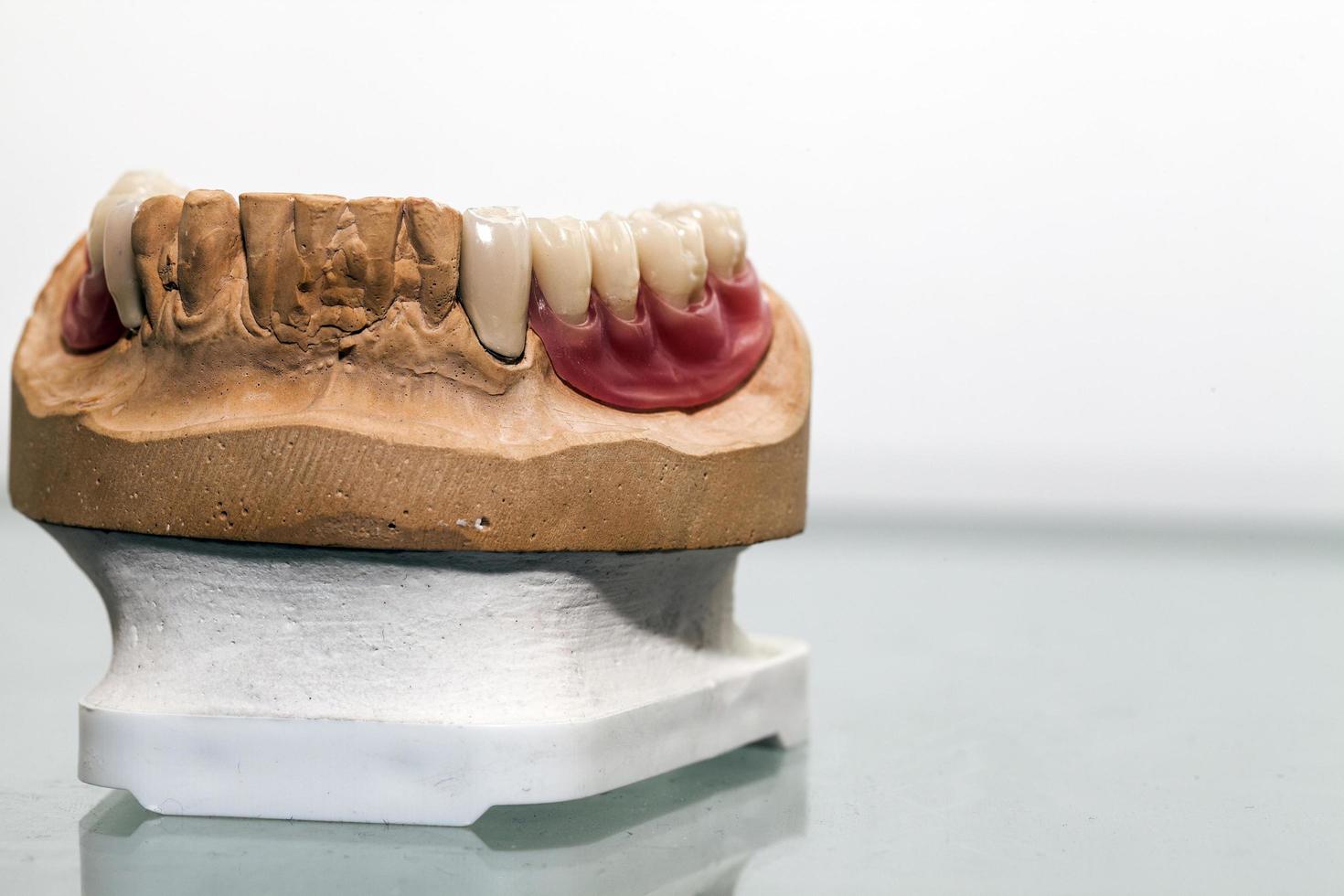 Zirconium Porcelain Tooth plate in Dentist Store photo