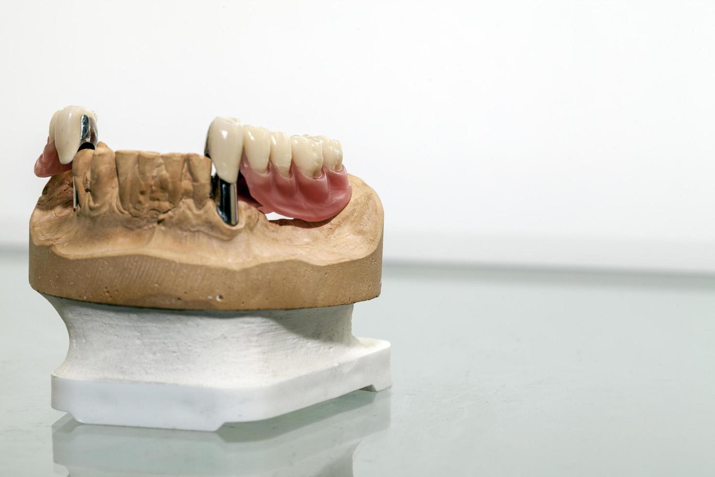Placa dental de porcelana de circonio en la tienda del dentista foto