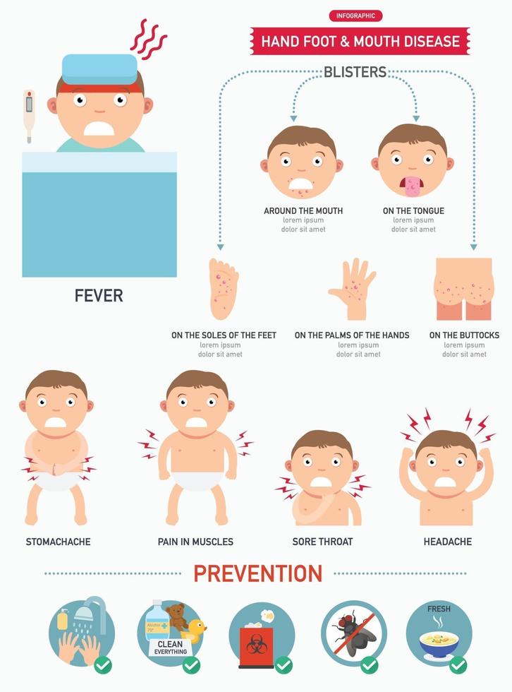 Hand,foot and mouth disease infographic vector