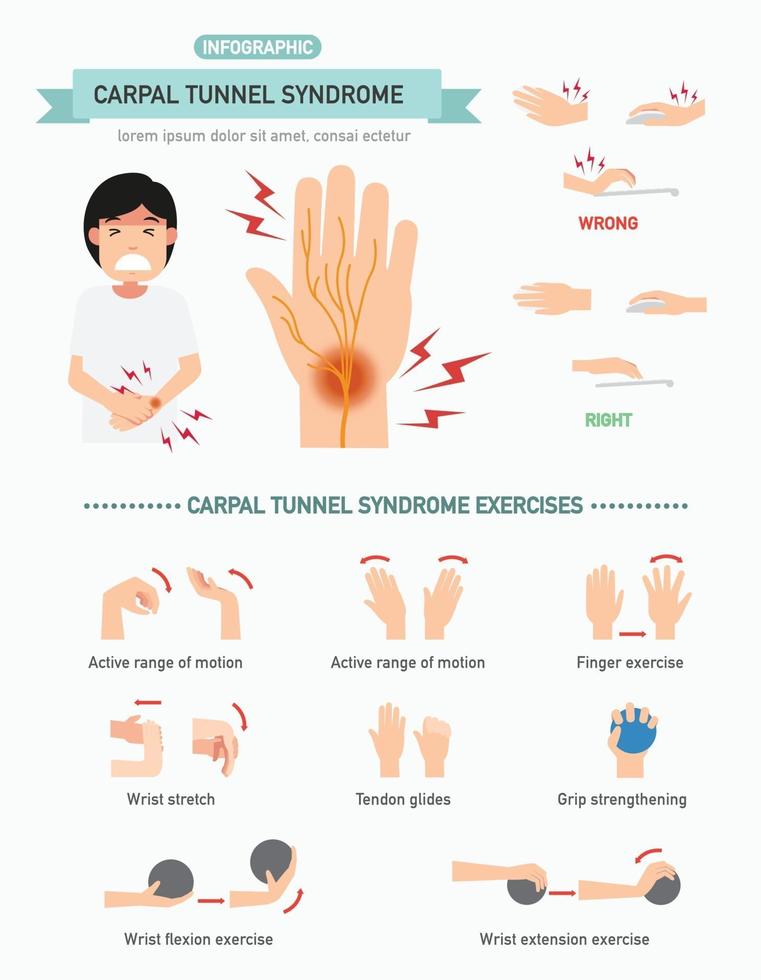 infografía del síndrome del túnel carpiano, ilustración. vector