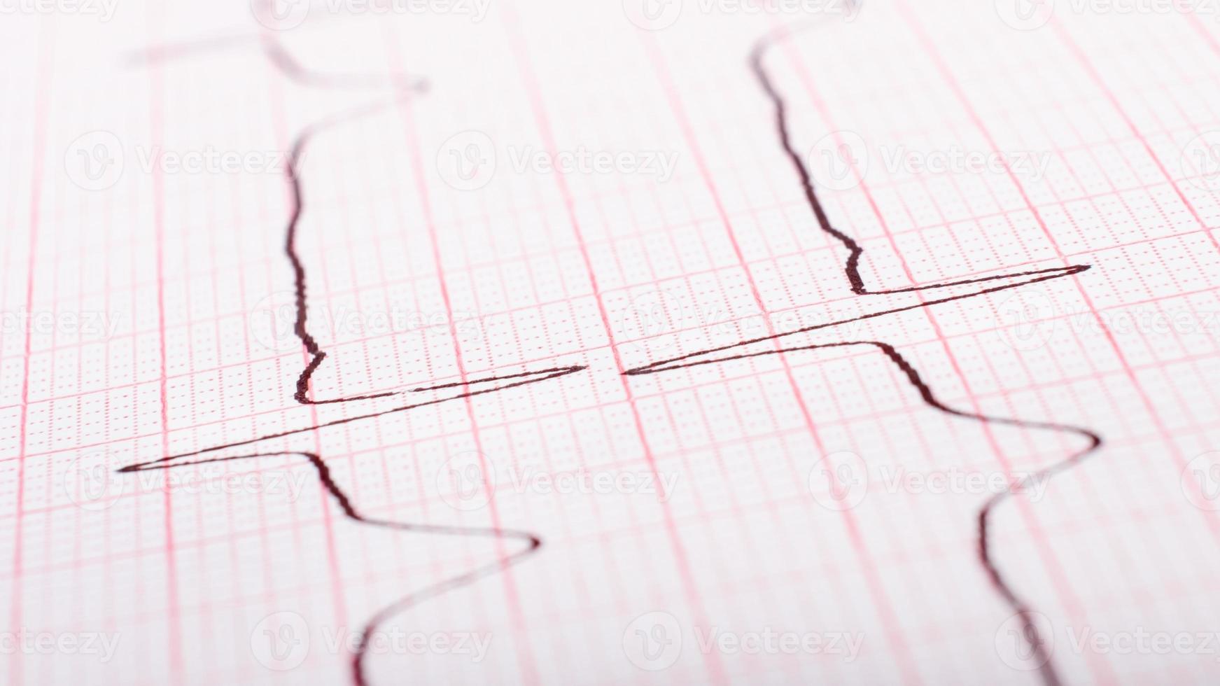 Heart rate on paper cardiogram closeup. photo