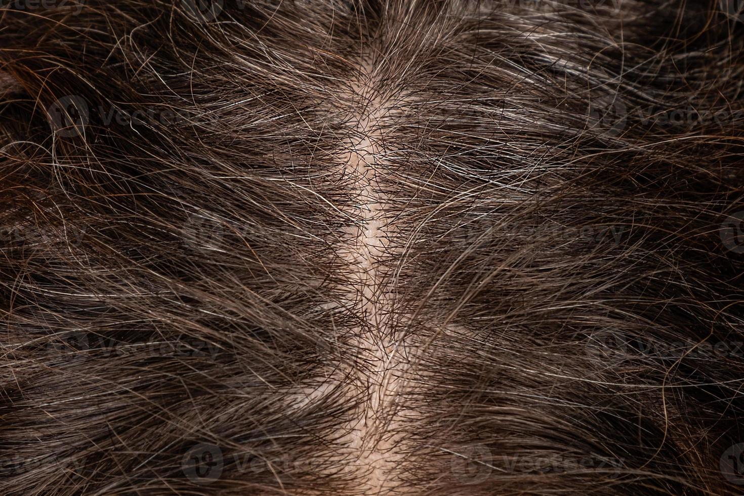 Female head roots closeup on which gray hair begins to appear. photo