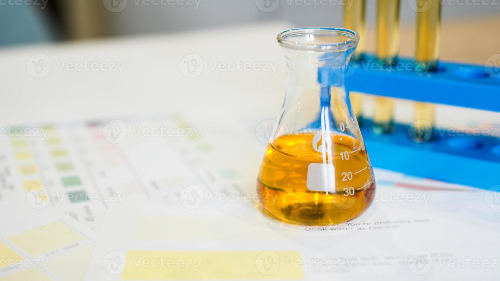 Flask and test tubes with urine on medical color schemes photo