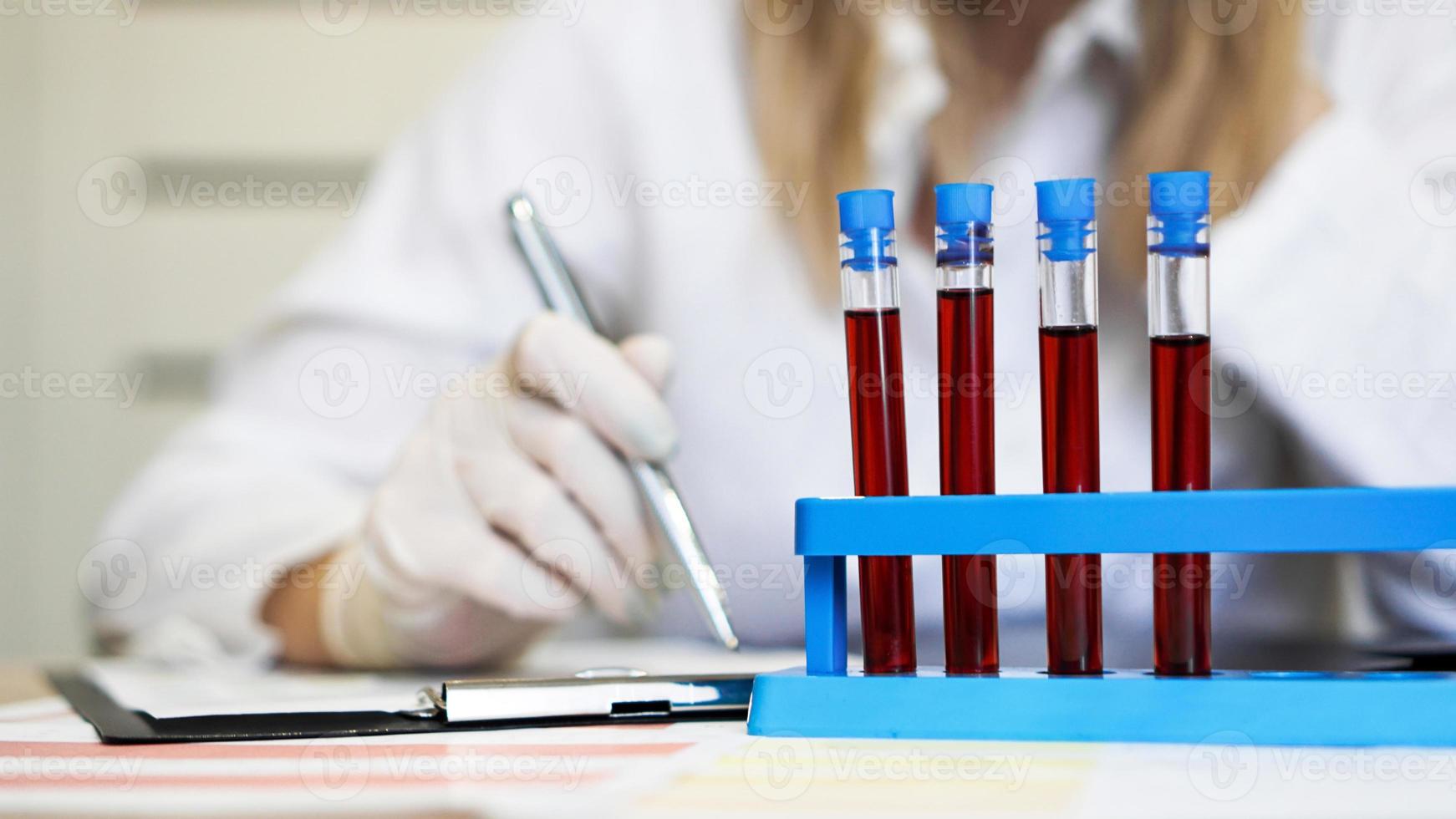Mujer que trabaja con muestras de sangre en el laboratorio, primer plano foto