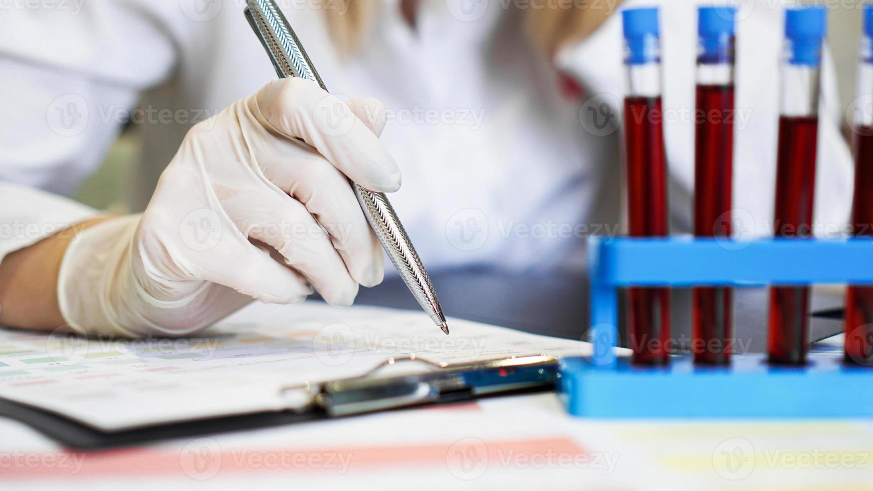 Mujer que trabaja con muestras de sangre en el laboratorio, primer plano foto