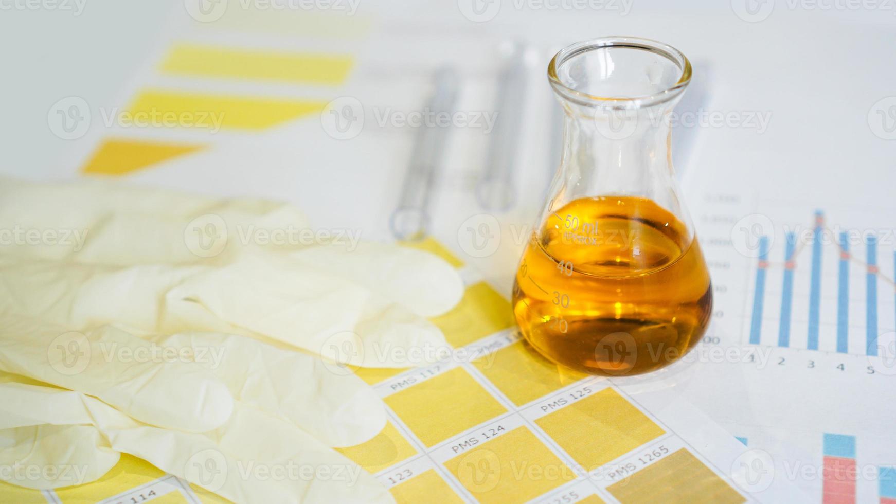 Urine test. Flask with analyzes on medical tables photo