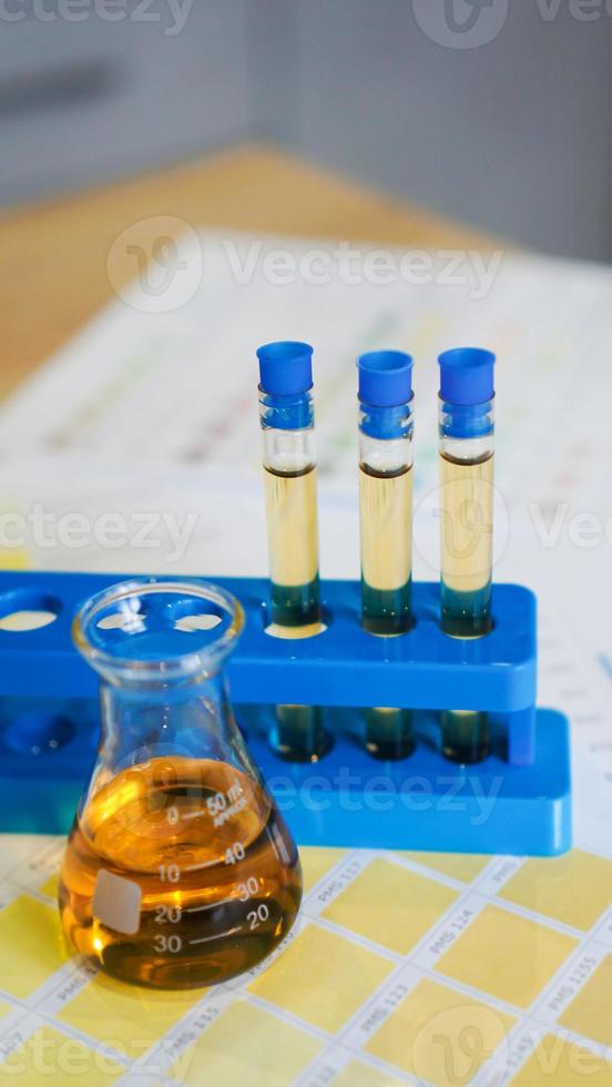 Flask and test tubes with urine on medical color schemes photo