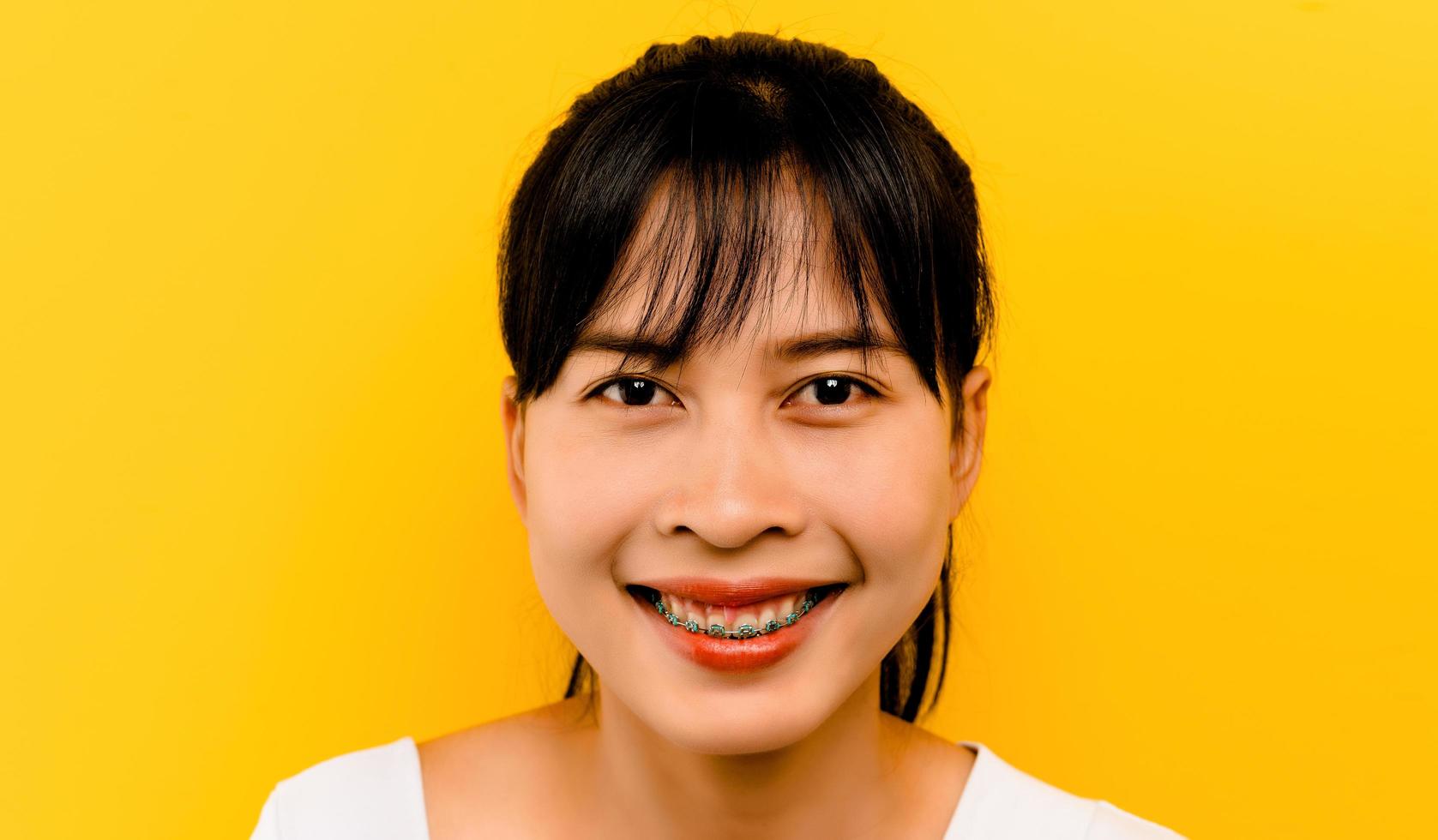 Asian smiling beautiful woman After orthodontics, take care photo