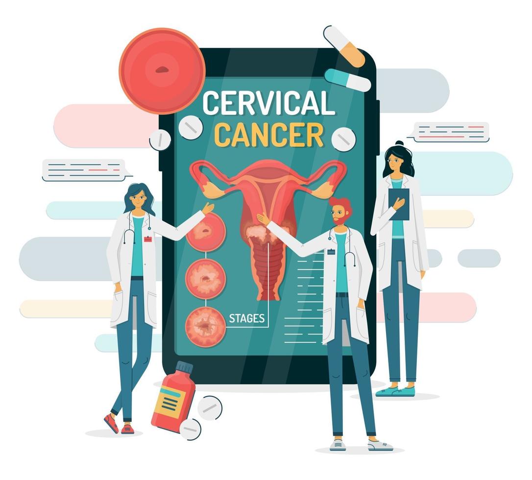 Cervical cancer on a smartphone with doctors vector