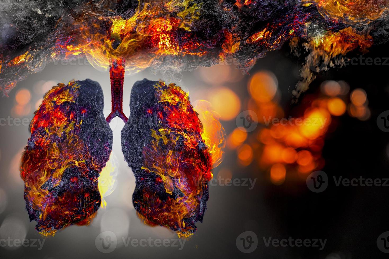 Illustration of lung tree Environment and Medicine photo