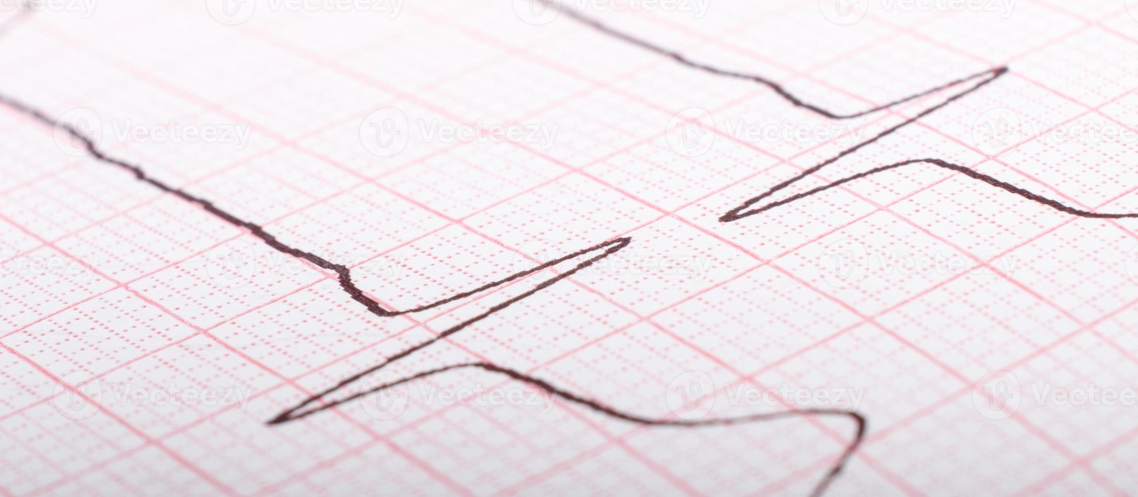 ekg cardiogram of heart impulses close up, hypertension treatment photo