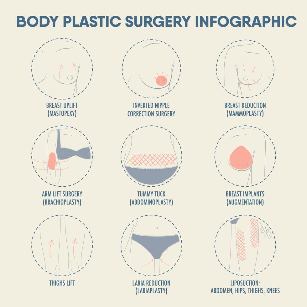 infografía de cirugía plástica corporal vector