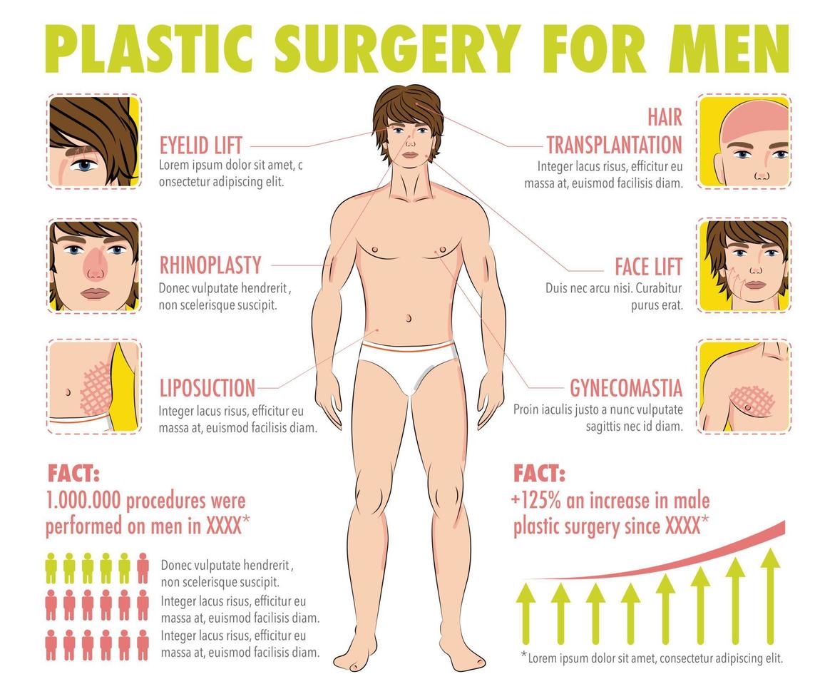 infografía de cirugía plástica corporal vector