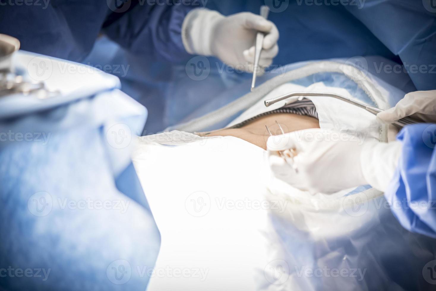 médicos con herramientas en las manos haciendo cirugía en la sala de operaciones foto
