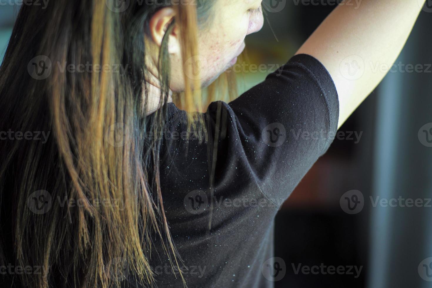 Rear view of woman having the dandruff on the shoulder. Acne photo