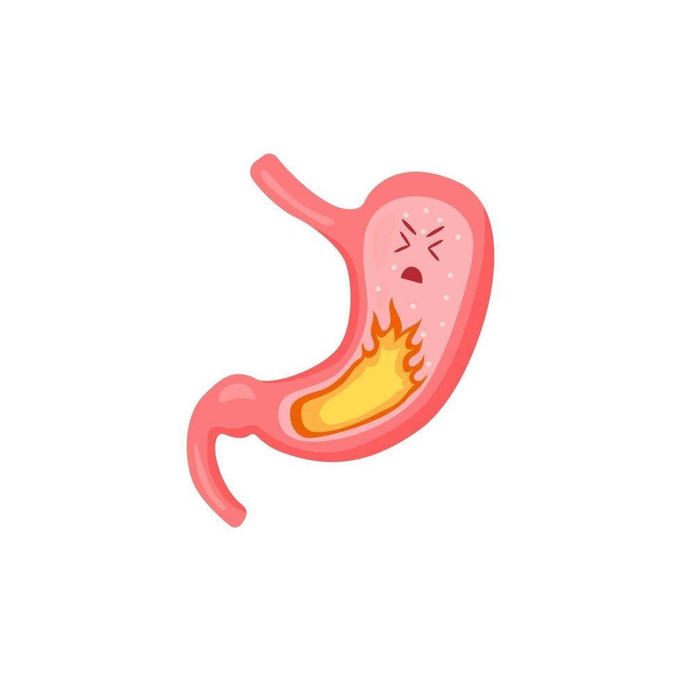 絵画 In my stomach stomach healthy stomach sick set 2969479 Vector Art at Vecteezy