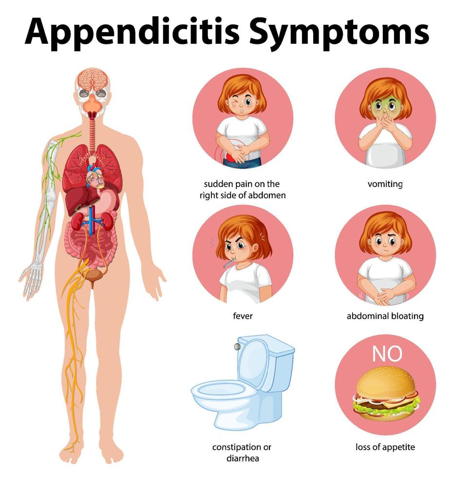 infografía de información de síntomas de apendicitis vector