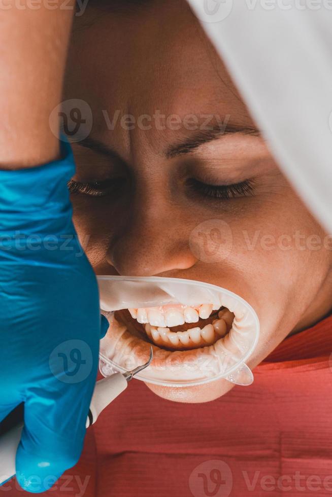 eliminación de sarro, uso de ultrasonido, paciente y dentista. foto