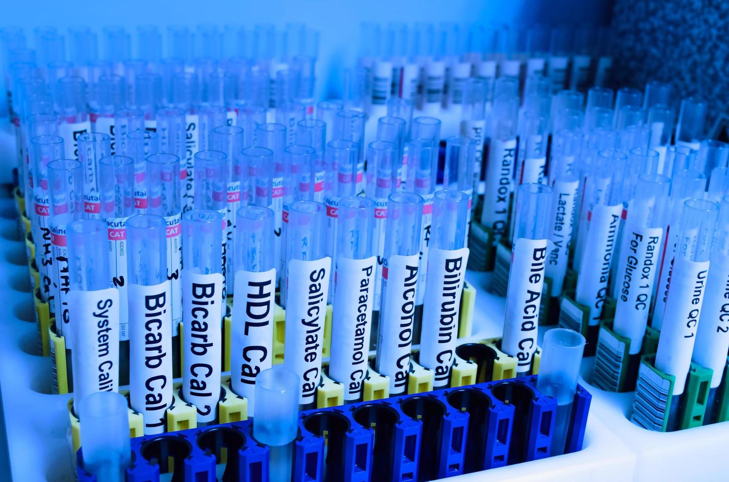 test tubes in a laboratory photo