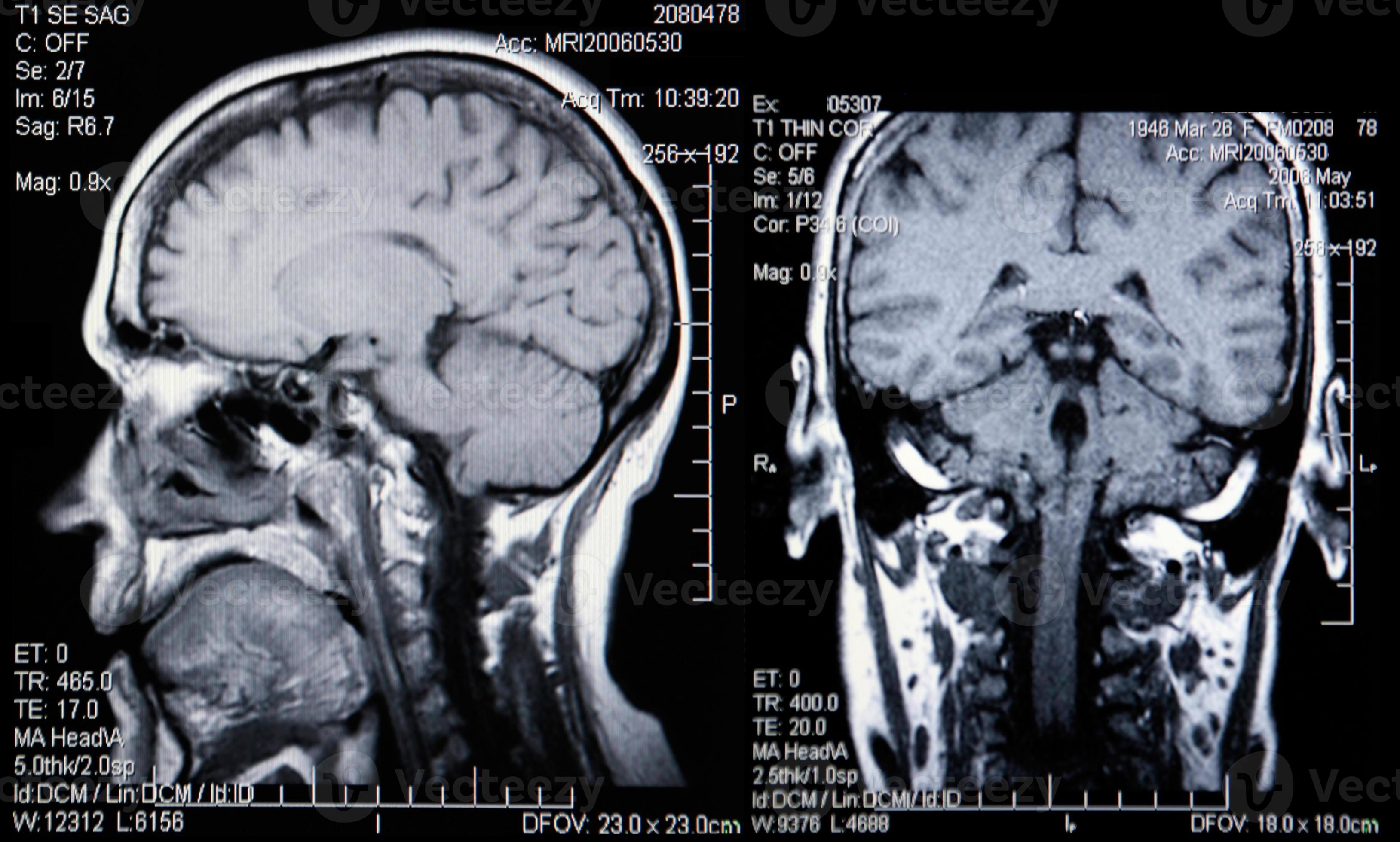 Real MRI Scans of the Head and Brain 3636996 Stock Photo at Vecteezy