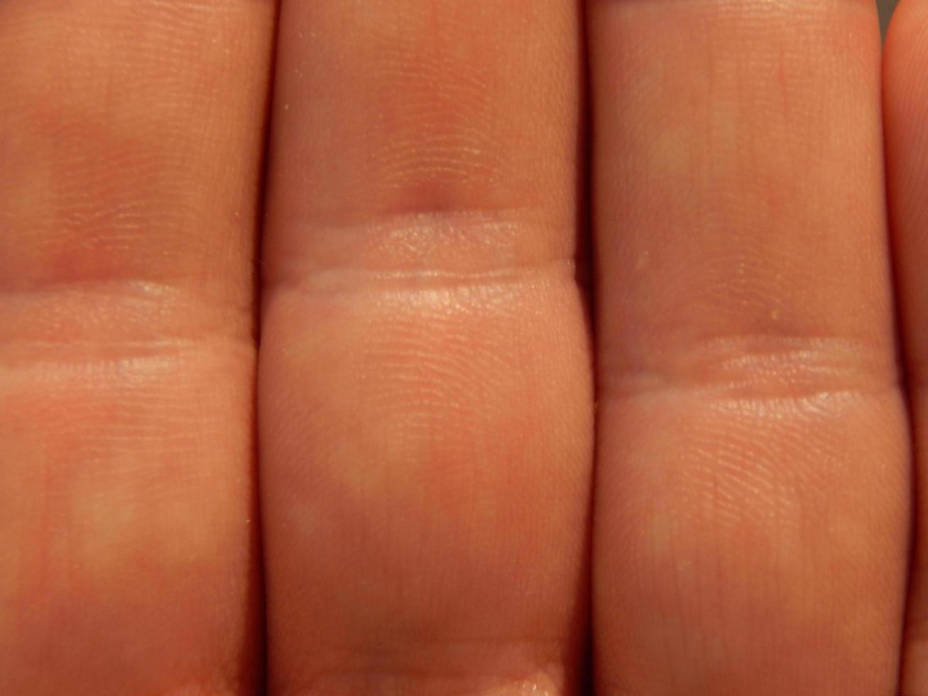 Human skin texture in various parts of the body photo