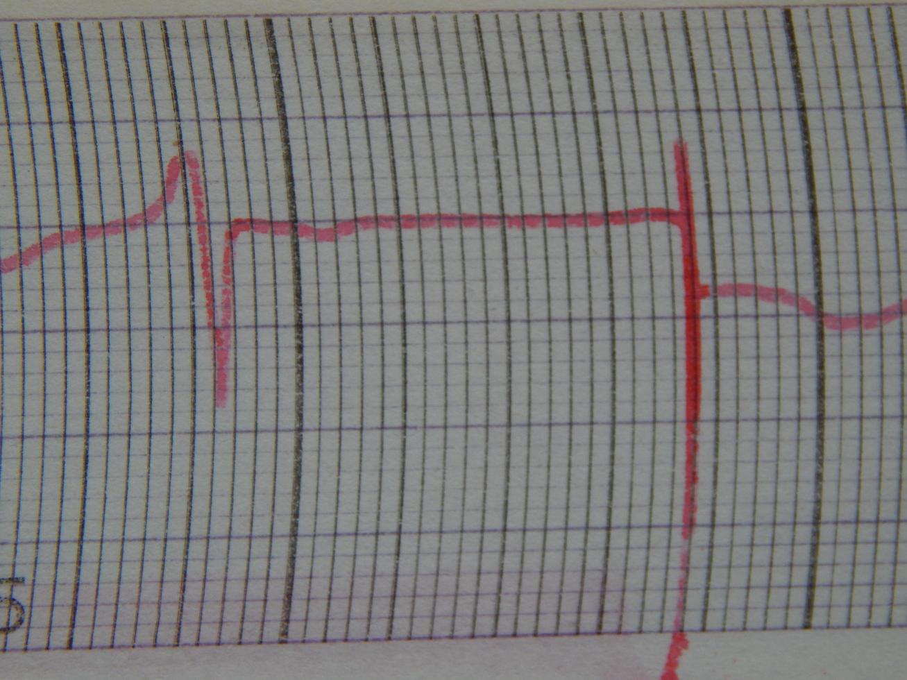 Scientific charts, cardiograms and mathematical calculations photo