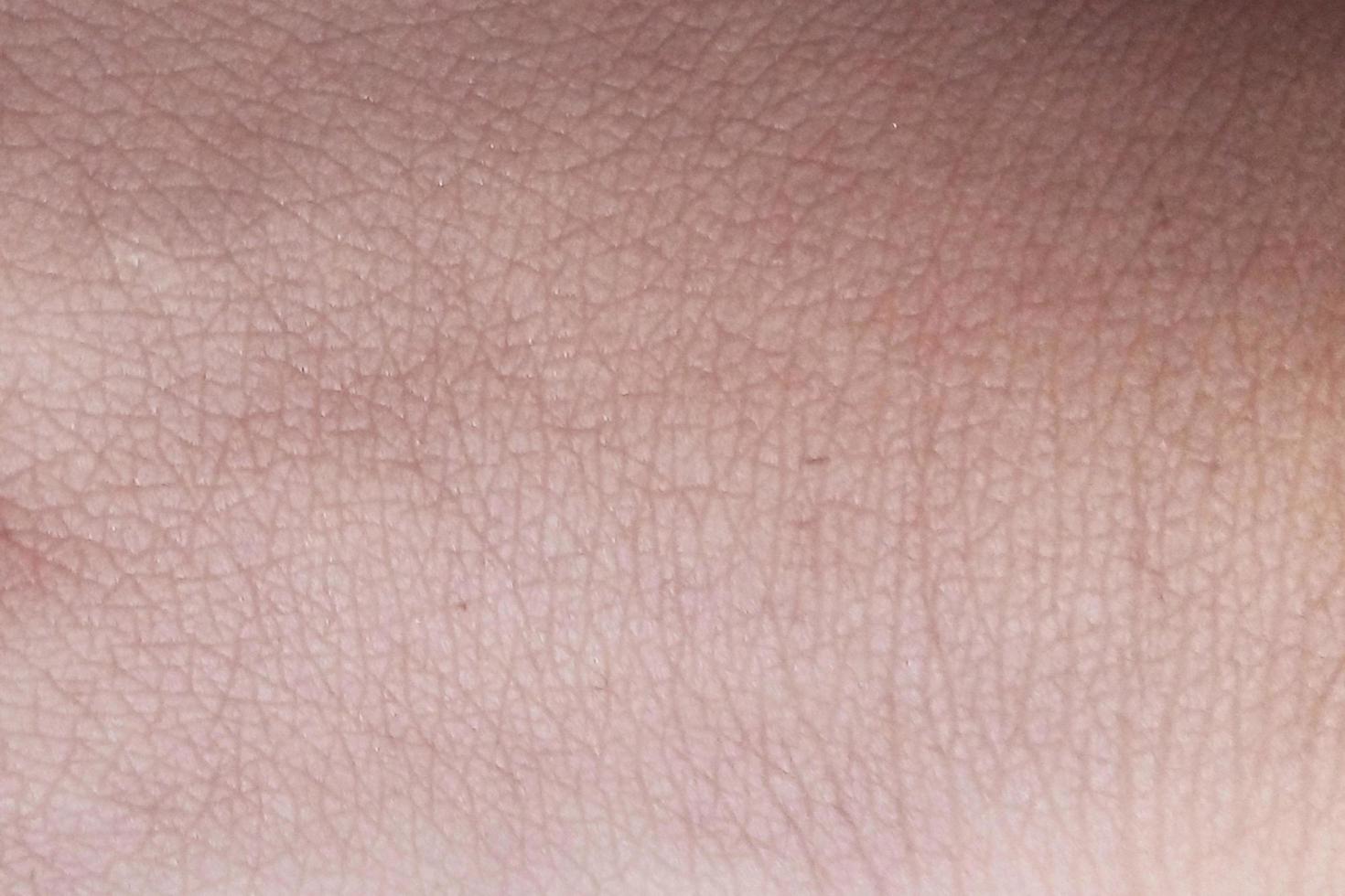 Natural Skin Texture Stock Background 3681130 Stock Photo at Vecteezy
